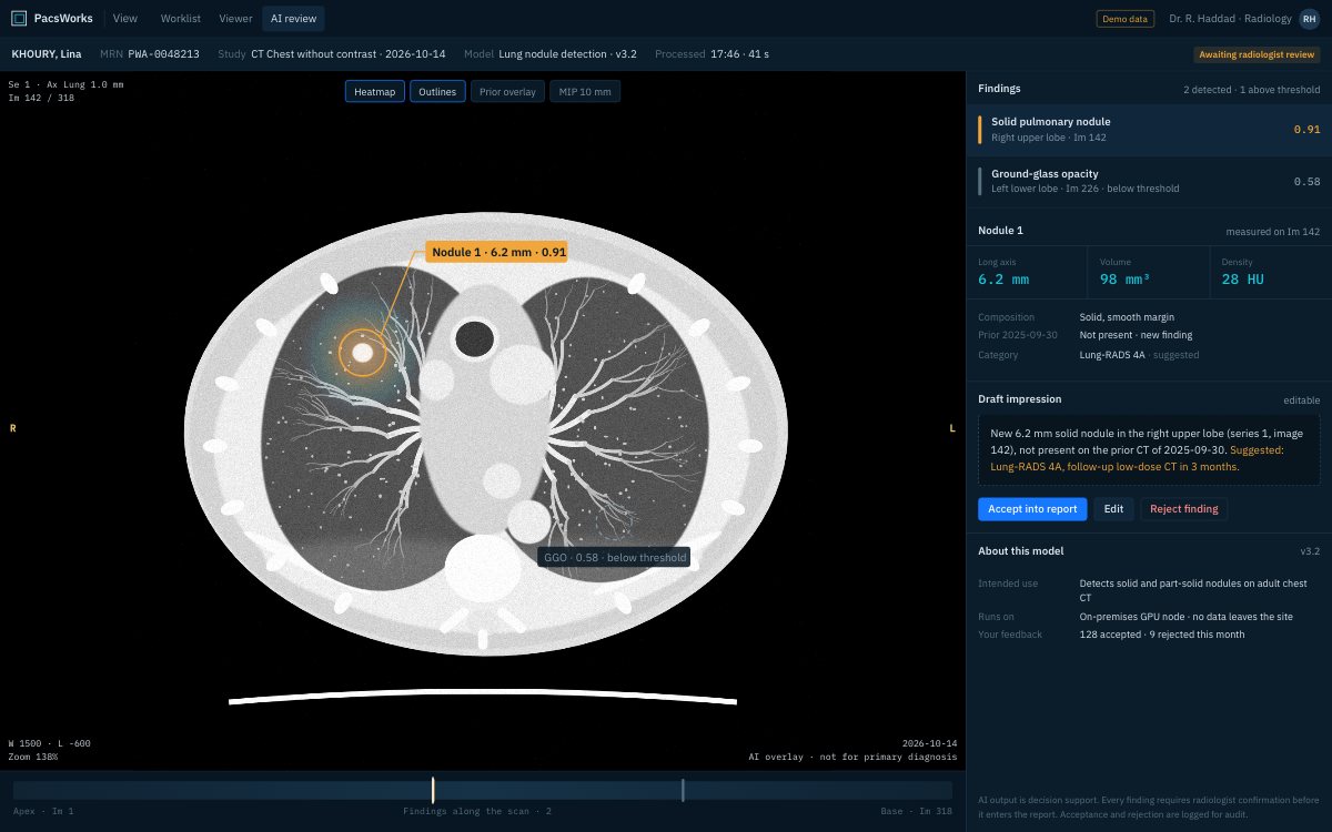 AI-assisted review screen with a nodule finding, heatmap and draft impression