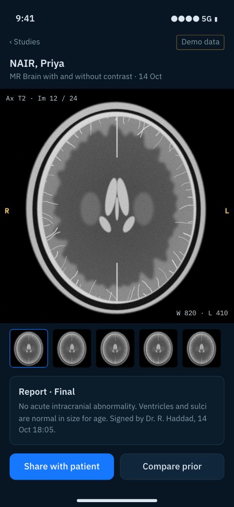 PacsWorks View on a phone: brain MR series with the report summary