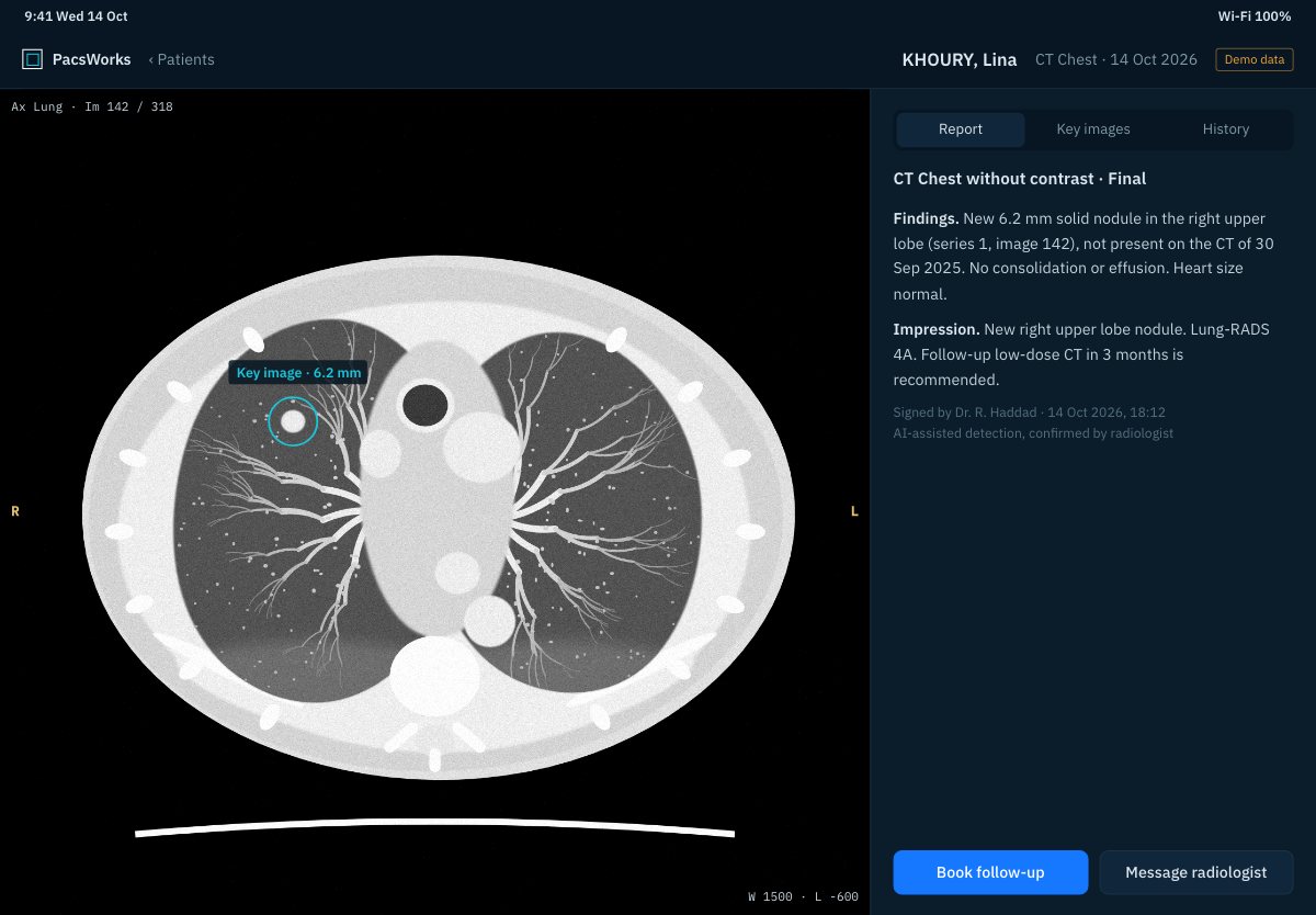 PacsWorks View on a tablet: chest CT with a key image and the signed report beside it